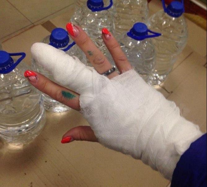Девушка, пострадавшая от «нападения» дрона компании Дом.ру, обратилась в полицию